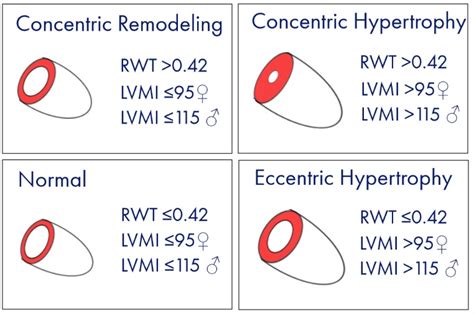 lv mass index normal range|left atrial volume index calculator.